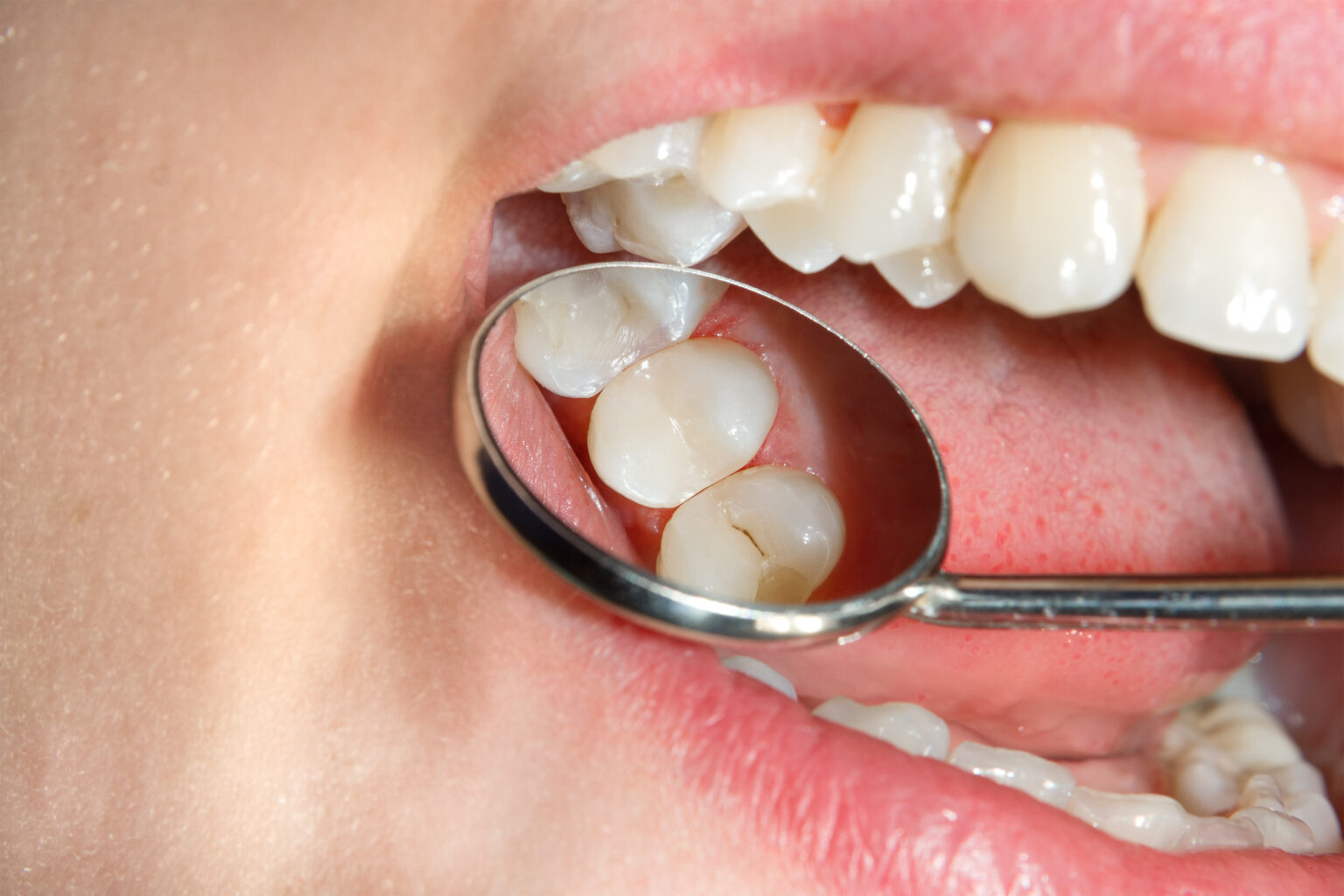 Pacific Dental | Dental Implants, Braces & Cosmetic Dentistry